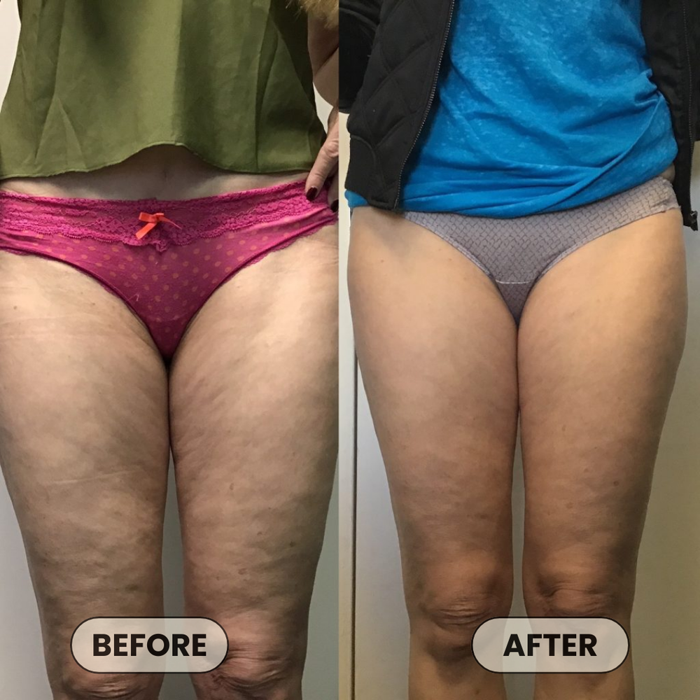 <p>Real Stories From Women Like You</p>